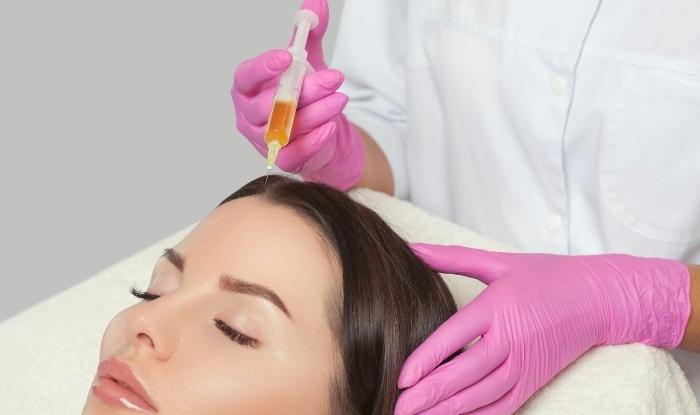 Doctora en consulta de estética con jeringa inyectando Plasma Rico en Plaquetas para tratamiento capilar.