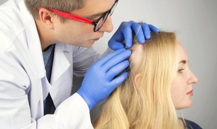 Doctor diagnosticando la Alopecia Areata en la cabeza de una paciente.