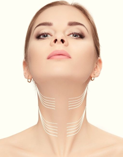Mujer mostrado su cuello con marcas de lápiz haciendo referencia a el lifting de cuello sin cirugía.
