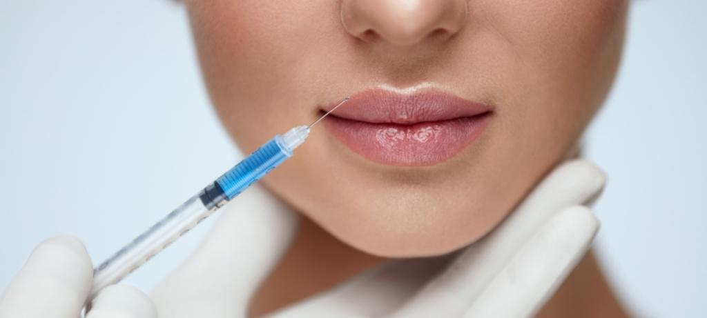Inyección en labios de mujer para tratamiento de aumento de labios