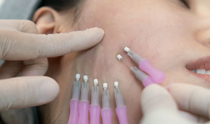 Rostro de mujer con Mallado de PDO